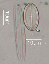 Diatom